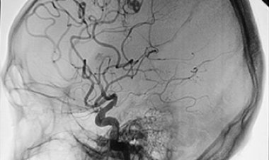 Brain dead patient gave life to 8 people: Struggled with death for 4 days