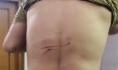 Delhi High Court lawyer attacked in Panipat; Miscreants hit the car