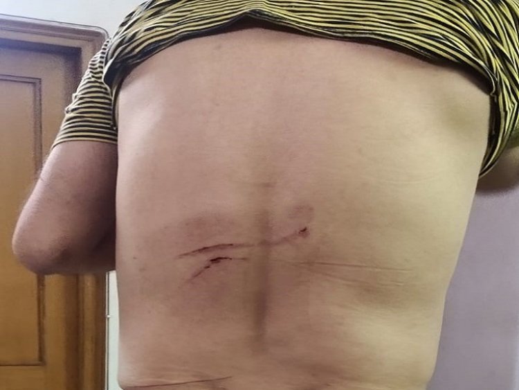 Delhi High Court lawyer attacked in Panipat; Miscreants hit the car