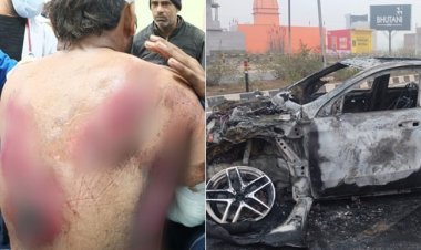 Rishabh Pant was badly injured when his car hit a divider and caught fire