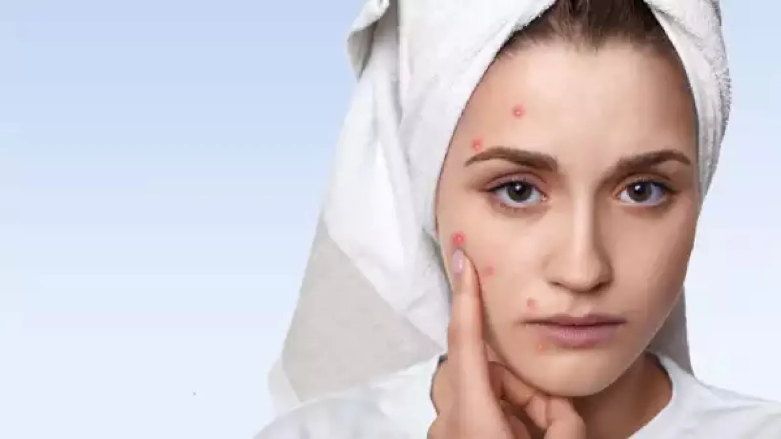 Pimples on different parts of the face tell the internal condition of the body
