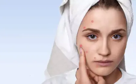 Pimples on different parts of the face tell the internal condition of the body