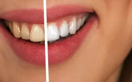 Neem, Mint, Orange Peel & Guava: Simple Ayurvedic Hacks for Whiter Teeth